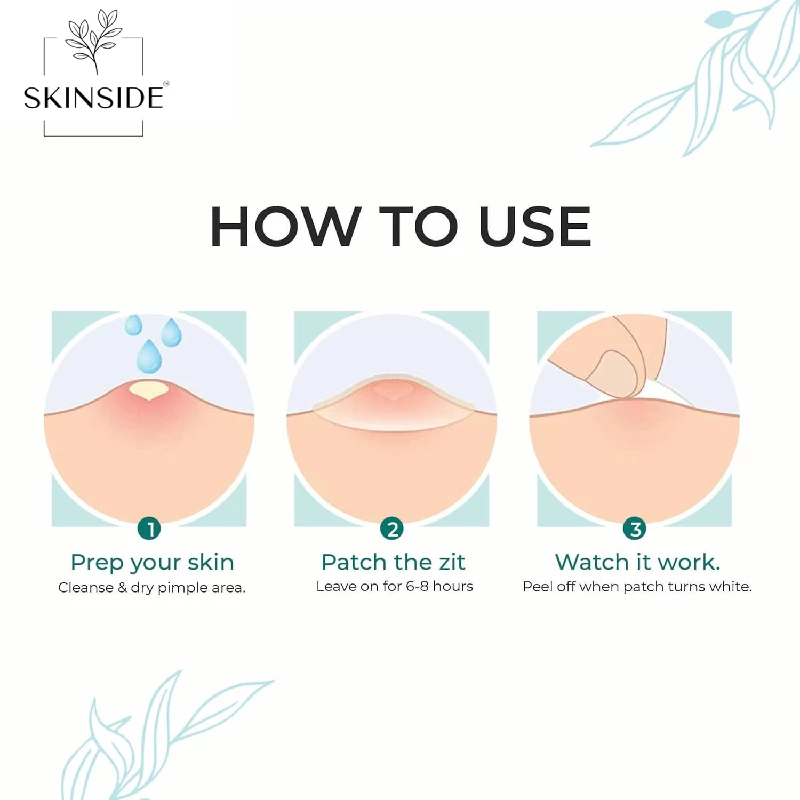 Skinside Acne Pimple Patches for Face Pimple, 72 Patches-3.webp